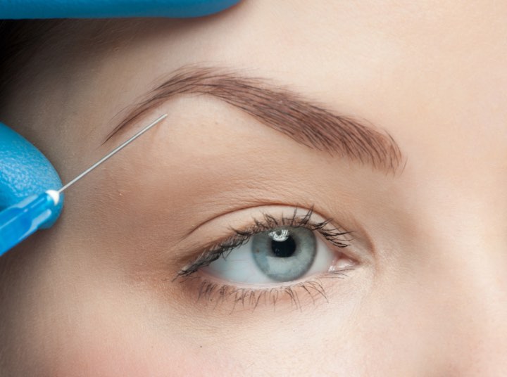 Types of Brow Lift