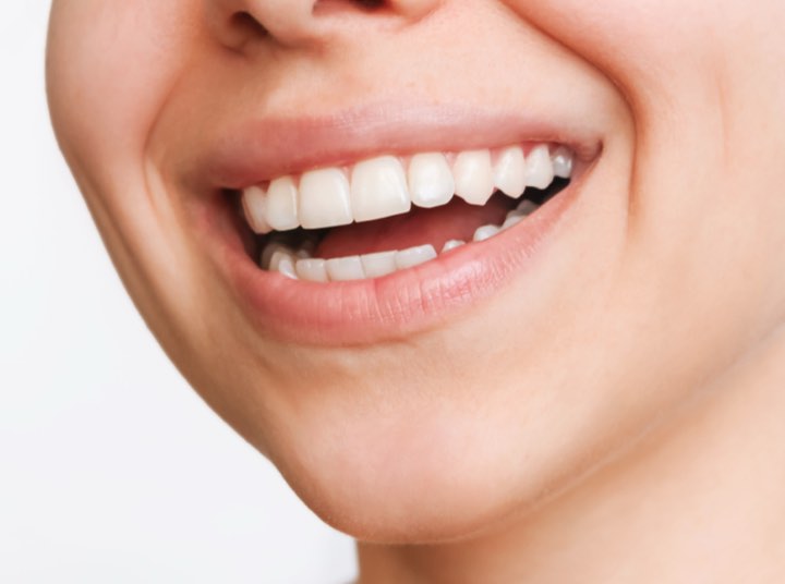 Types of Dimpleplasty 2