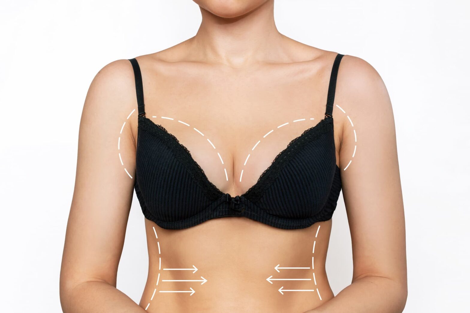 Featured image for post: How Much is a Breast Reduction?